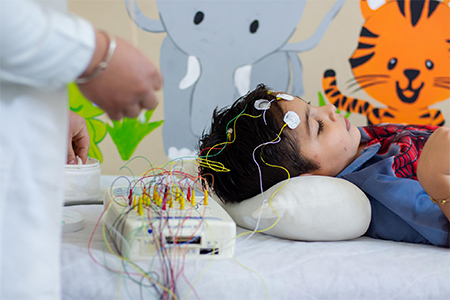 epilepsia infantil