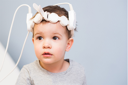 repercusiones epilepsia